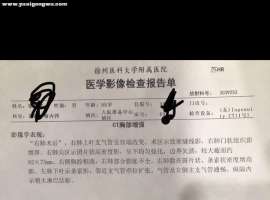 右肺上叶切除，术前术后对比