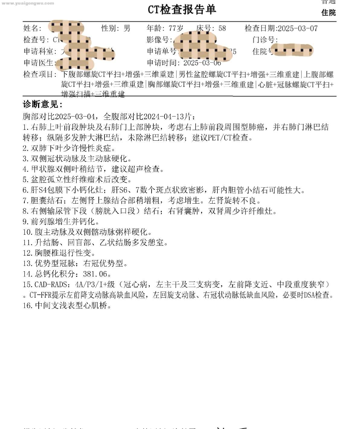 胸腹部+盆腔增强CT报告2